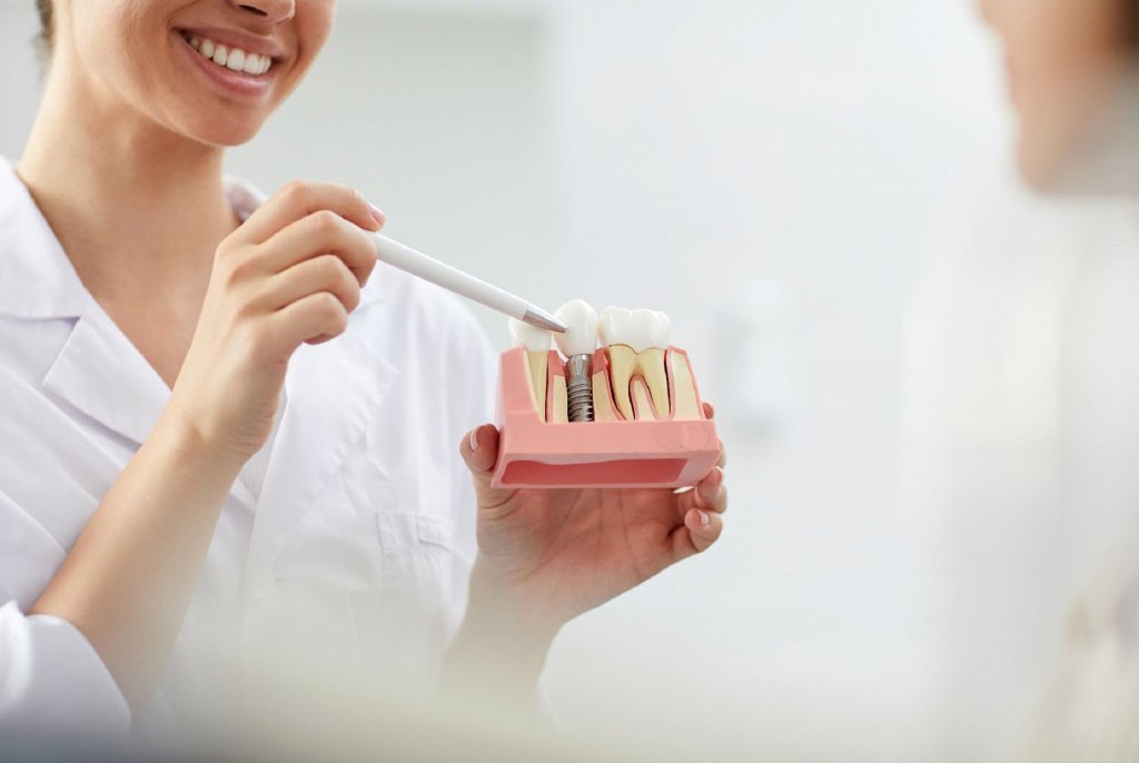 wstawianie implantów stomatologicznych