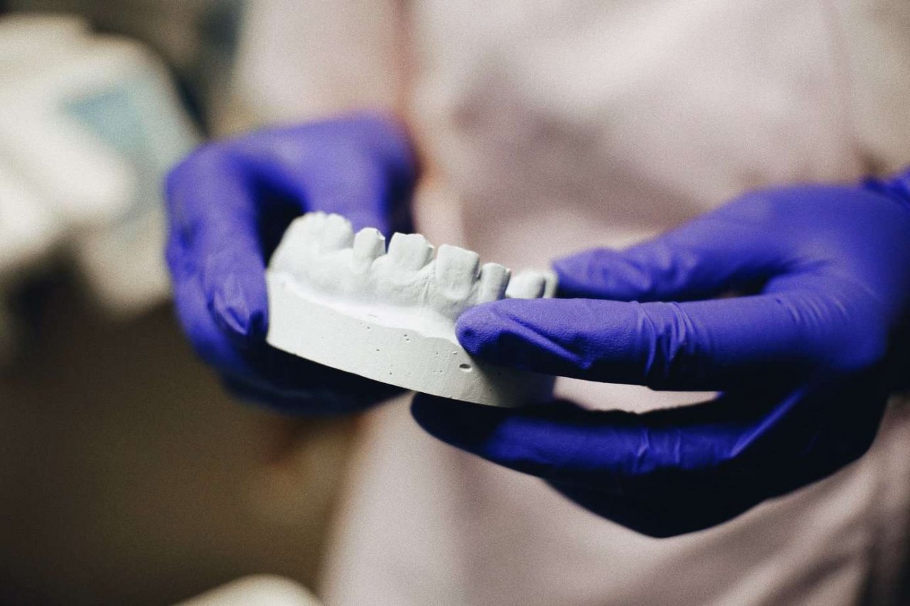 Kiedy warto wstawić implant zębowy?